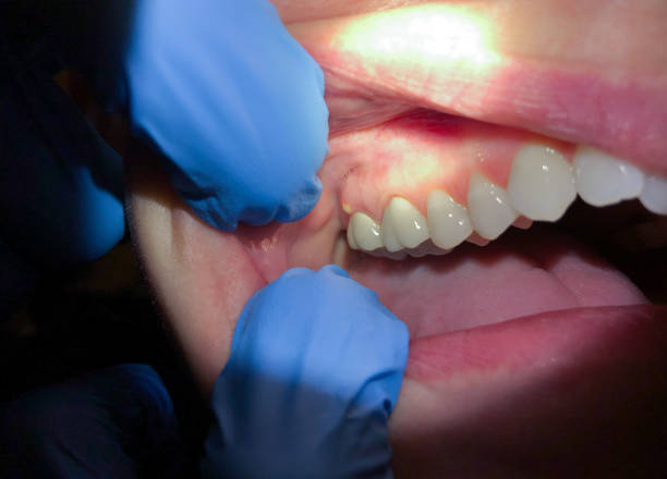 Best Emergency Dental Surgery in Brisbane, CA